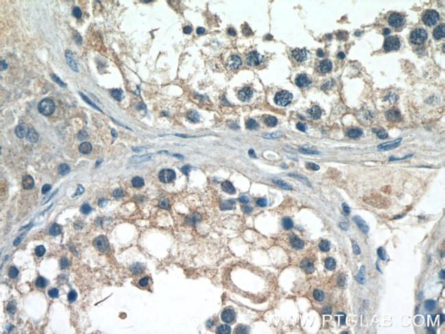 CST9L Antibody in Immunohistochemistry (Paraffin) (IHC (P))