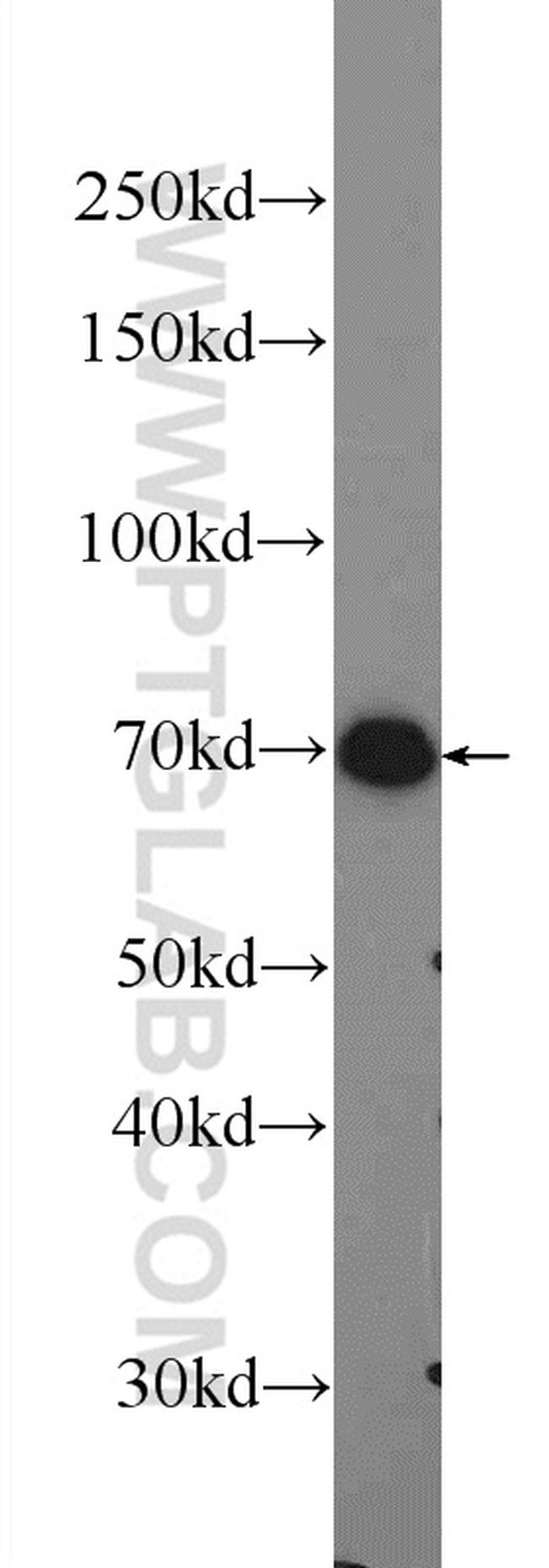 PRAM1 Antibody in Western Blot (WB)