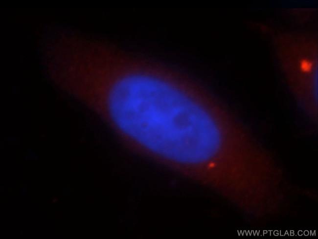 DNASE1L1 Antibody in Immunocytochemistry (ICC/IF)