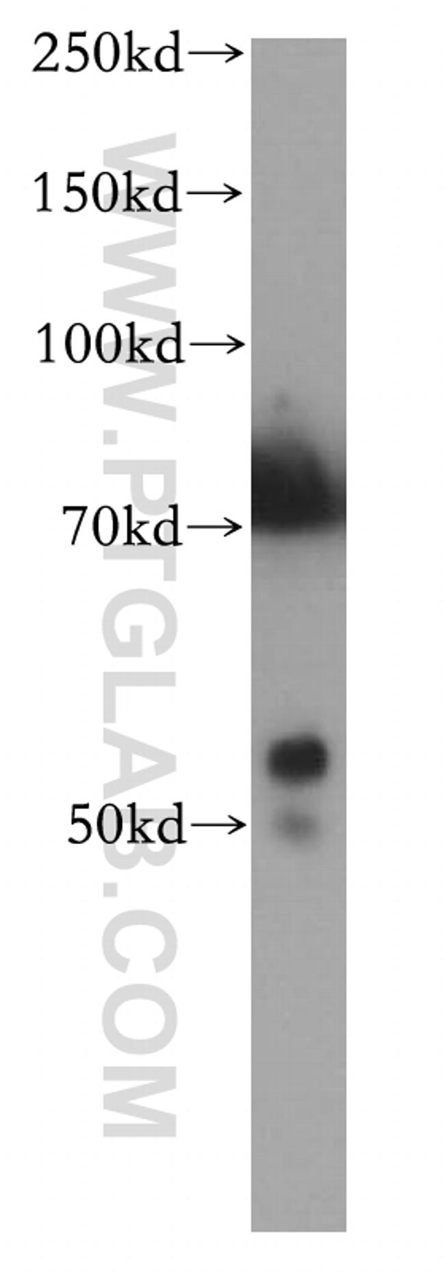 CYP2S1 Antibody in Western Blot (WB)