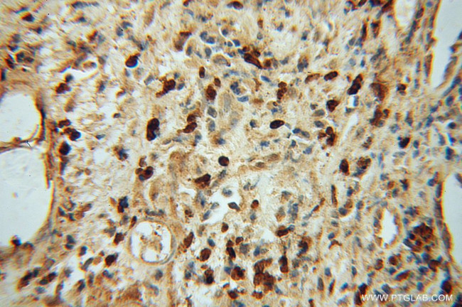 NR2C1 Antibody in Immunohistochemistry (Paraffin) (IHC (P))