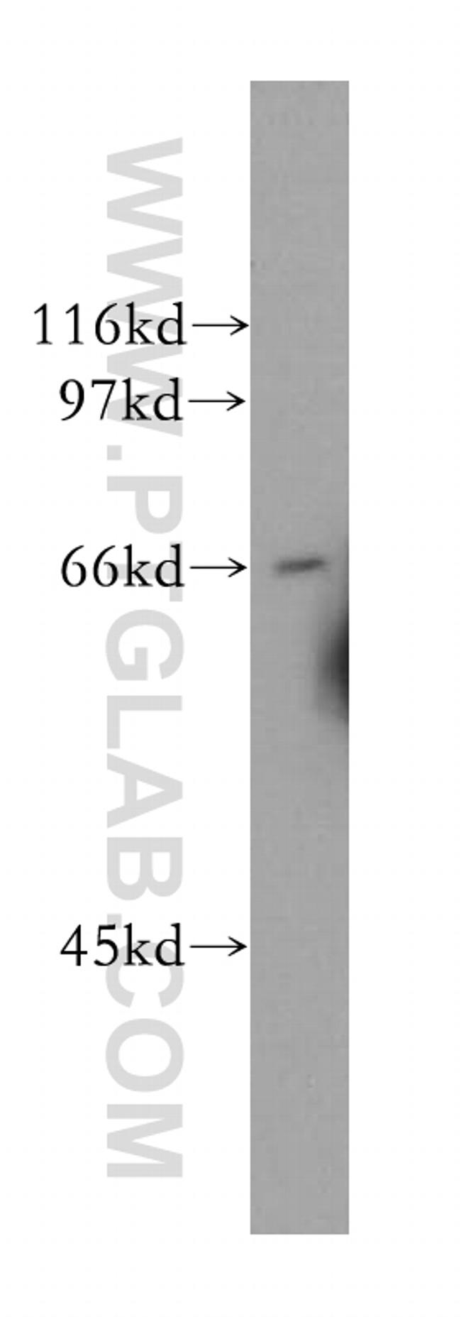 CDC14A Antibody in Western Blot (WB)