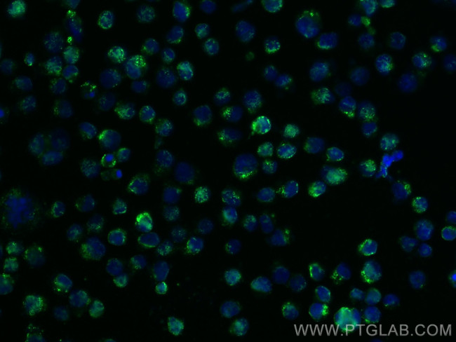 TRIM17 Antibody in Immunocytochemistry (ICC/IF)