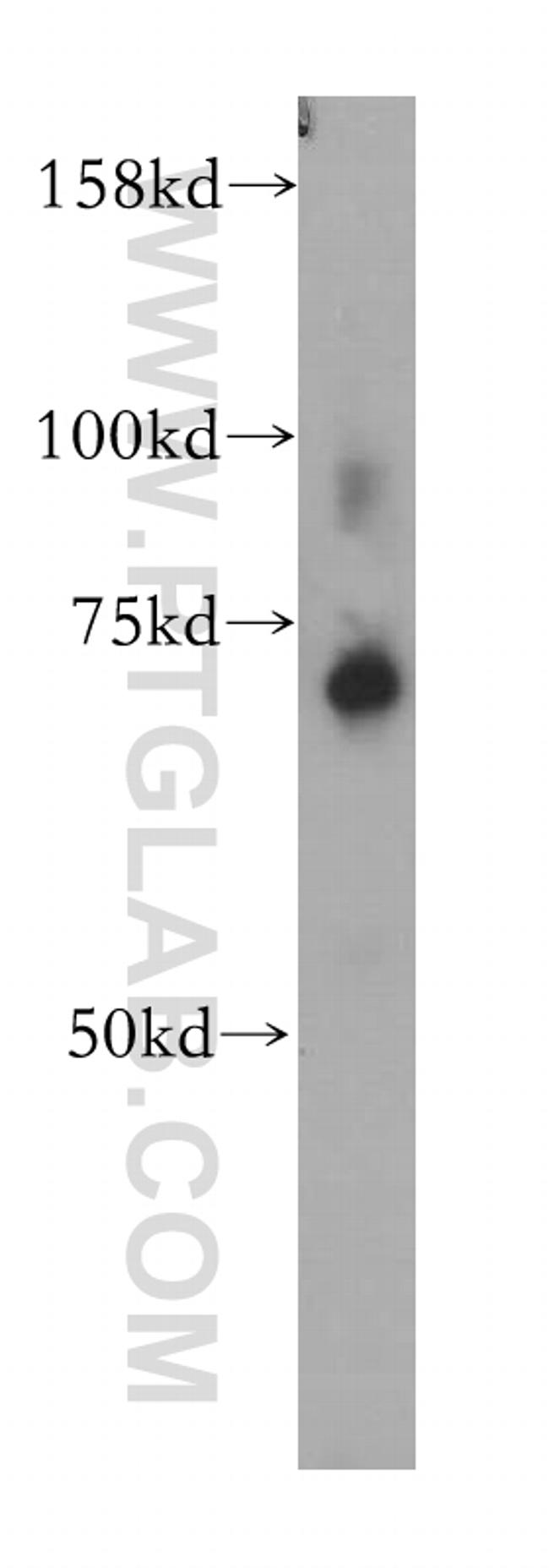 ZNF443 Antibody in Western Blot (WB)