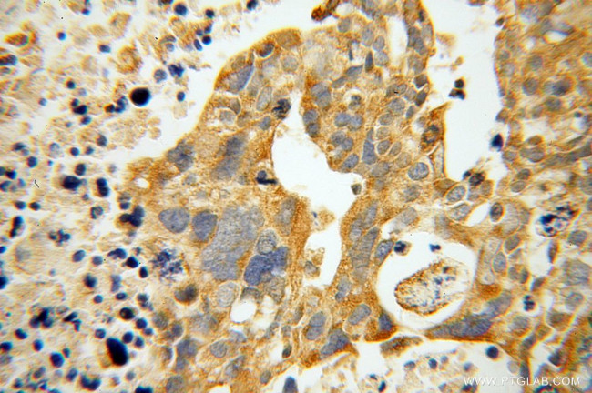 ATP11B Antibody in Immunohistochemistry (Paraffin) (IHC (P))