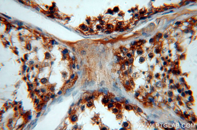 WDR1 Antibody in Immunohistochemistry (Paraffin) (IHC (P))