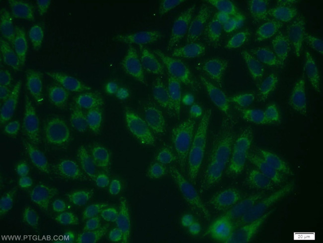 VEGFR-1/FLT-1 Antibody in Immunocytochemistry (ICC/IF)