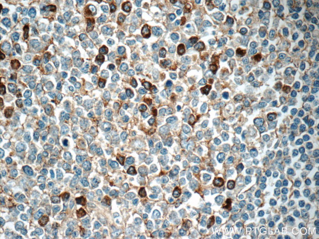 IGJ Antibody in Immunohistochemistry (Paraffin) (IHC (P))