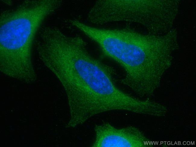 HERC4 Antibody in Immunocytochemistry (ICC/IF)