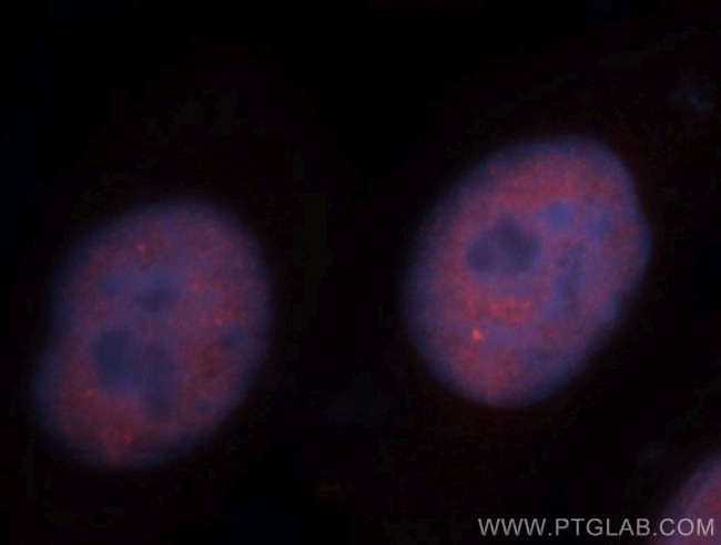 IRF2BP1 Antibody in Immunocytochemistry (ICC/IF)