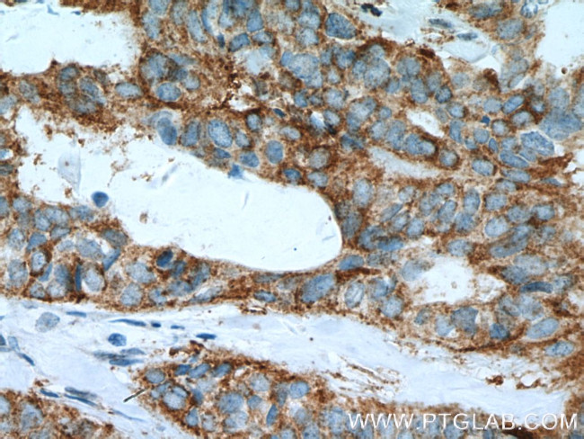 FMO5 Antibody in Immunohistochemistry (Paraffin) (IHC (P))