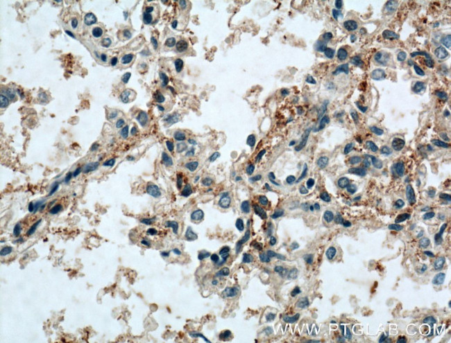 SCARF1 Antibody in Immunohistochemistry (Paraffin) (IHC (P))