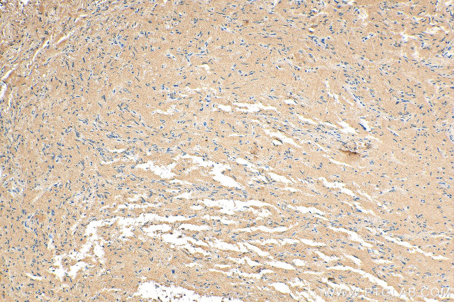 Calcyon Antibody in Immunohistochemistry (Paraffin) (IHC (P))