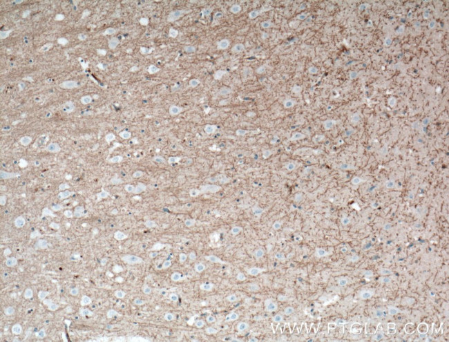 DGCR2 Antibody in Immunohistochemistry (Paraffin) (IHC (P))