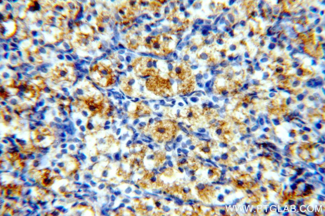 PNCK Antibody in Immunohistochemistry (Paraffin) (IHC (P))