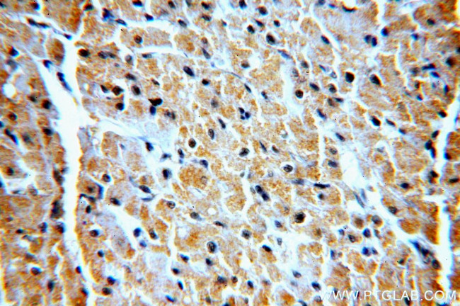 VPS34 Antibody in Immunohistochemistry (Paraffin) (IHC (P))