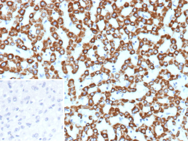 CPS1/Carbamoyl-Phosphate Synthetase (Hepatocellular Marker) Antibody in Immunohistochemistry (Paraffin) (IHC (P))