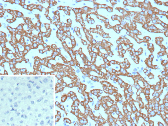 CPS1/Carbamoyl-Phosphate Synthetase (Hepatocellular Marker) Antibody in Immunohistochemistry (Paraffin) (IHC (P))