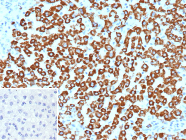 CPS1/Carbamoyl-Phosphate Synthetase (Hepatocellular Marker) Antibody in Immunohistochemistry (Paraffin) (IHC (P))