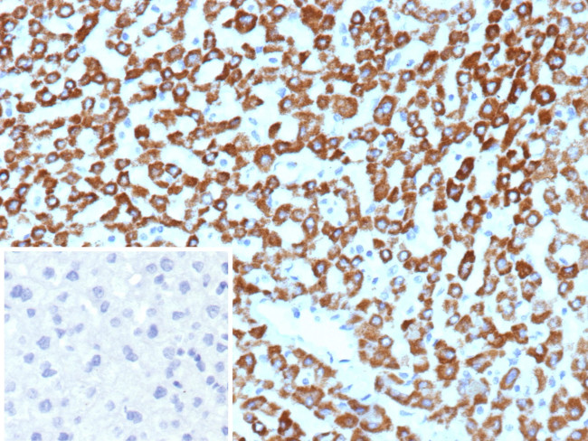 CPS1/Carbamoyl-Phosphate Synthetase (Hepatocellular Marker) Antibody in Immunohistochemistry (Paraffin) (IHC (P))