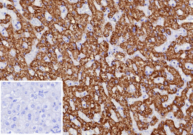 CPS1/Carbamoyl-Phosphate Synthetase (Hepatocellular Marker) Antibody in Immunohistochemistry (Paraffin) (IHC (P))