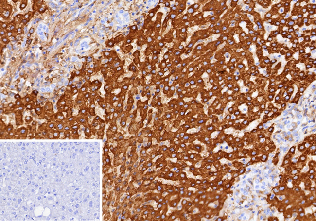 CPS1/Carbamoyl-Phosphate Synthetase (Hepatocellular Marker) Antibody in Immunohistochemistry (Paraffin) (IHC (P))