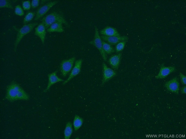 Carboxypeptidase A5 Antibody in Immunocytochemistry (ICC/IF)