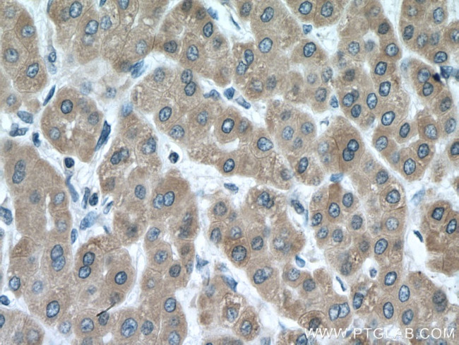 CYP3A5 Antibody in Immunohistochemistry (Paraffin) (IHC (P))