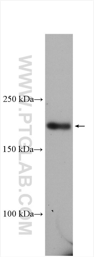 CUL7 Antibody in Western Blot (WB)