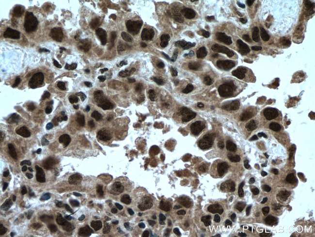TRIM22 Antibody in Immunohistochemistry (Paraffin) (IHC (P))