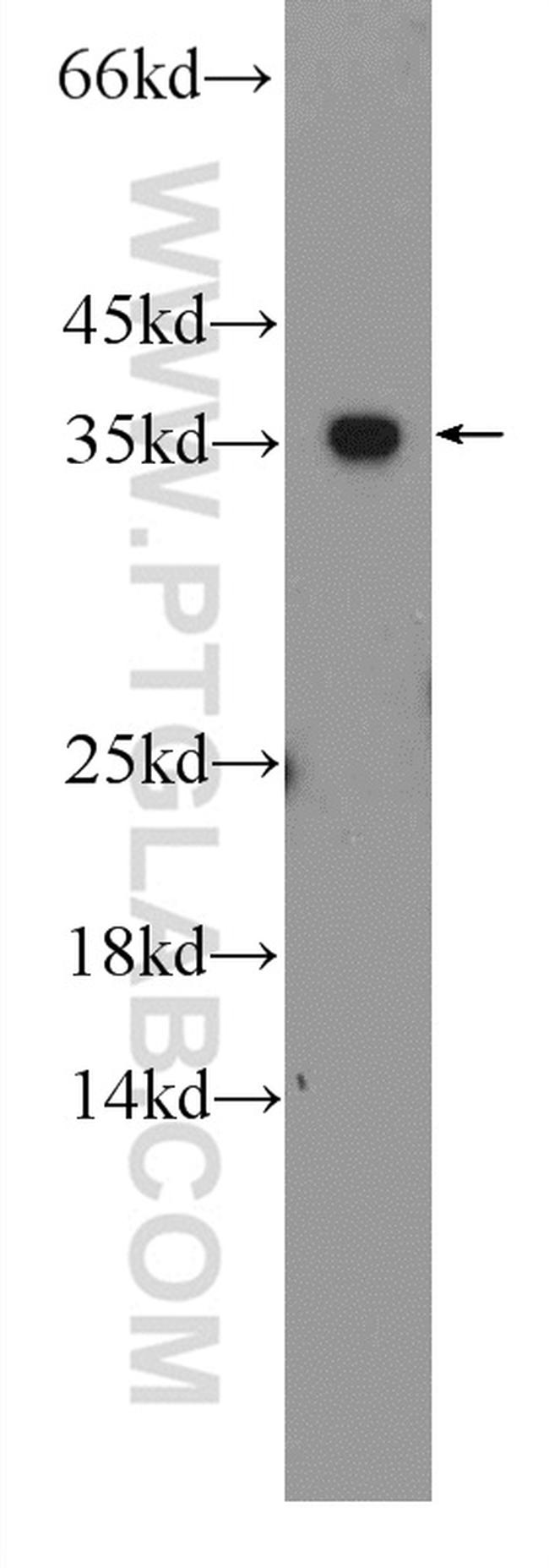 GADD45A Antibody in Western Blot (WB)