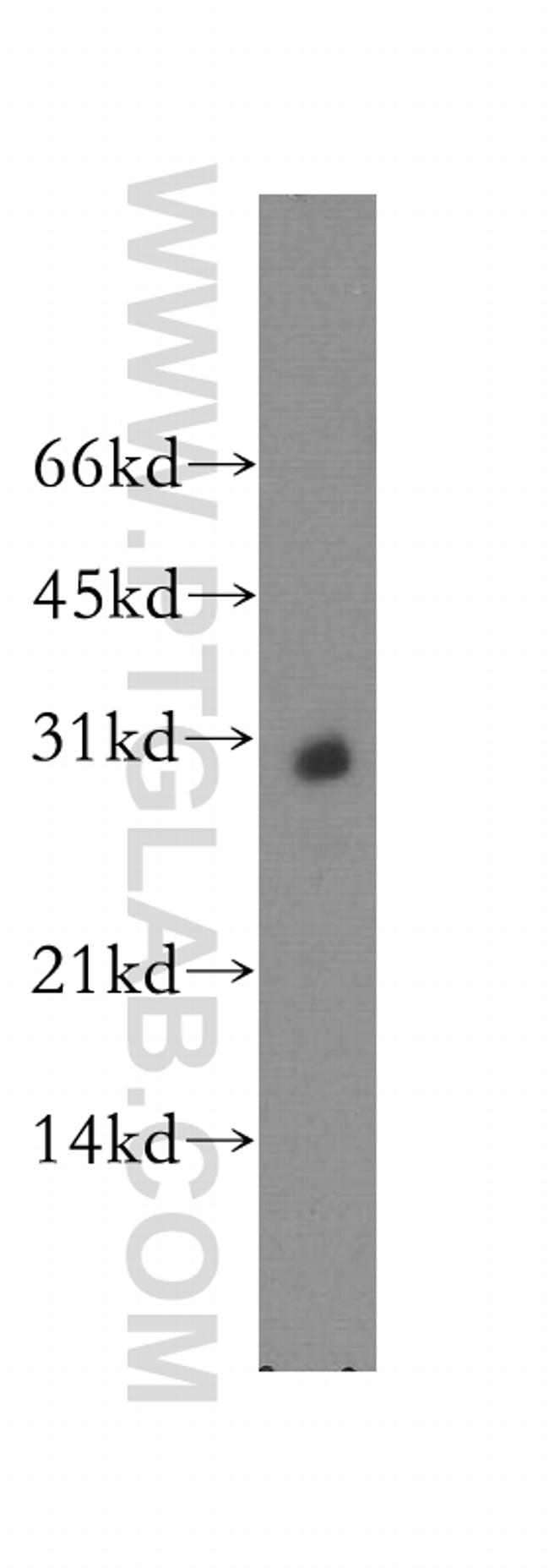 KCNIP4 Antibody in Western Blot (WB)