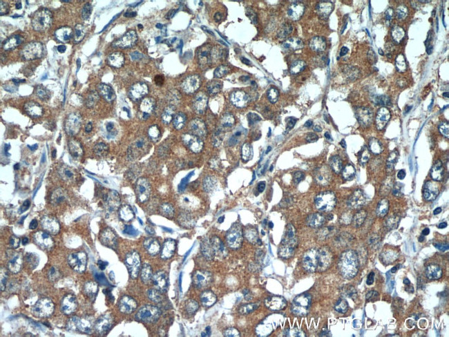 SLC7A5 Antibody in Immunohistochemistry (Paraffin) (IHC (P))