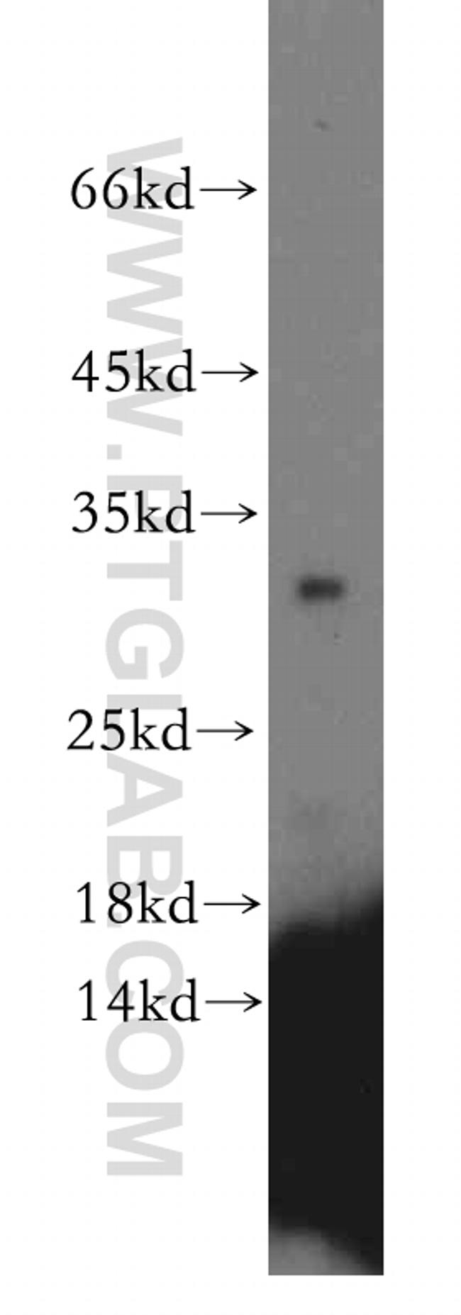 CRYBB1 Antibody in Western Blot (WB)