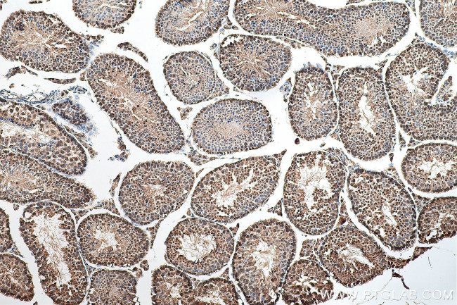 CDC2L6 Antibody in Immunohistochemistry (Paraffin) (IHC (P))