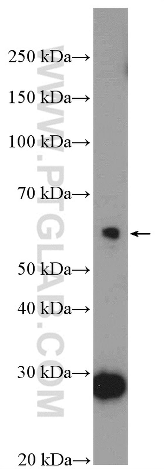 BTBD6 Antibody in Western Blot (WB)