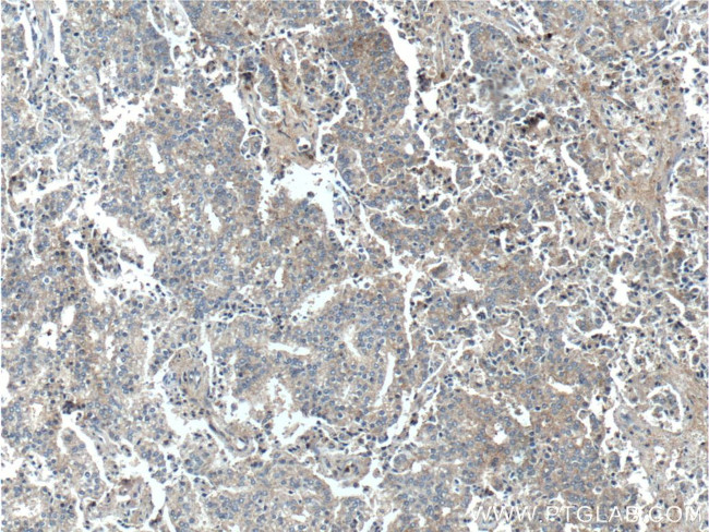 TSLP Antibody in Immunohistochemistry (Paraffin) (IHC (P))