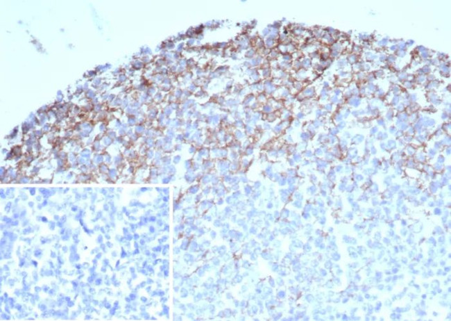 CD35/CR1 (Follicular Dendritic Cell Marker) Antibody in Immunohistochemistry (Paraffin) (IHC (P))