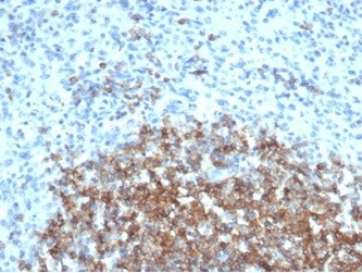 CD35/CR1 (Follicular Dendritic Cell Marker) Antibody in Immunohistochemistry (Paraffin) (IHC (P))