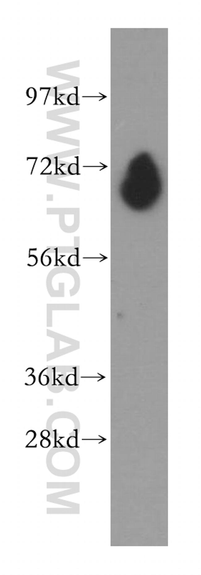 PDE1C Antibody in Western Blot (WB)