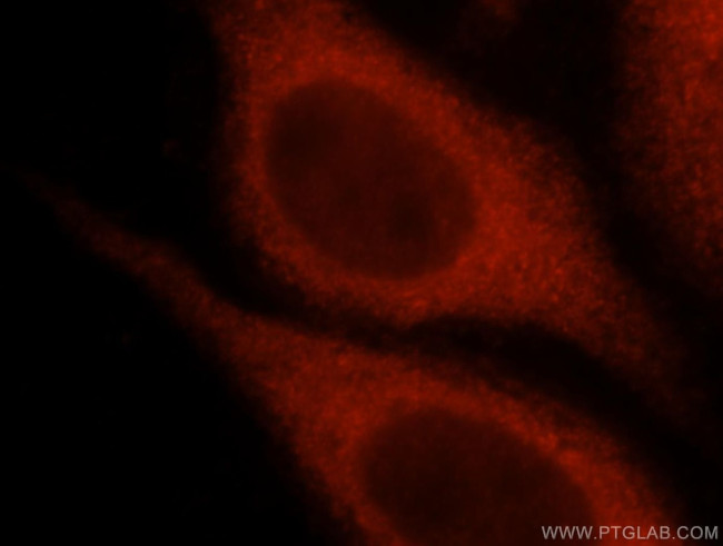 Spartin/SPG20 Antibody in Immunocytochemistry (ICC/IF)