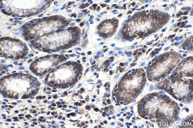 ELP2 Antibody in Immunohistochemistry (Paraffin) (IHC (P))