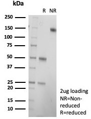 CD21 (Mature B-Cell and Follicular Dendritic Cell Marker) Antibody in Immunohistochemistry (Paraffin) (IHC (P))