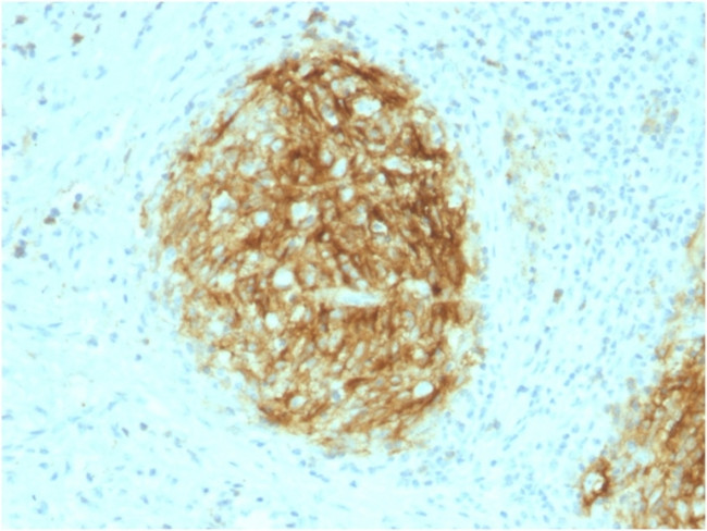 CD21 (Mature B-Cell and Follicular Dendritic Cell Marker) Antibody in Immunohistochemistry (Paraffin) (IHC (P))