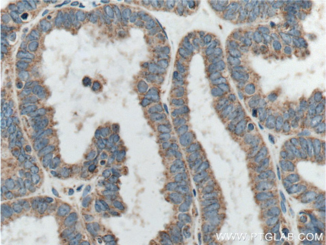 CORO2B Antibody in Immunohistochemistry (Paraffin) (IHC (P))