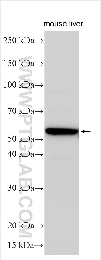 CYP4V2 Antibody in Western Blot (WB)