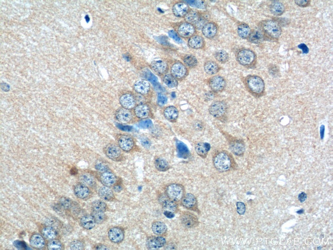 GLRA2 Antibody in Immunohistochemistry (Paraffin) (IHC (P))
