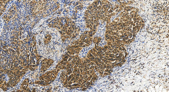 SETX Antibody in Immunohistochemistry (Paraffin) (IHC (P))