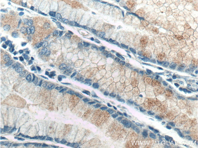 TAC1 Antibody in Immunohistochemistry (Paraffin) (IHC (P))