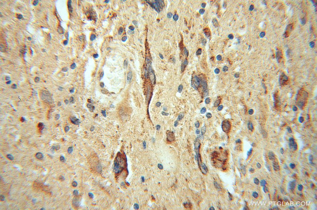 LRRC4C Antibody in Immunohistochemistry (Paraffin) (IHC (P))